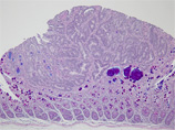 P2250030