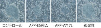 図１_iPS細胞の位相差顕微鏡写真.png