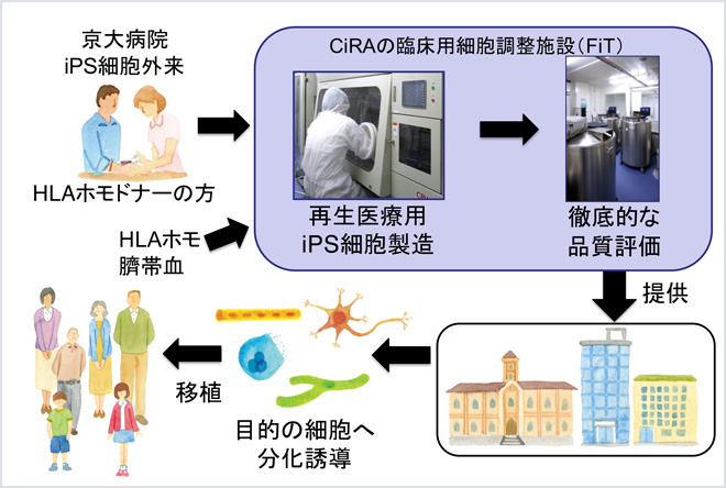 再生医療用iPS細胞ストック