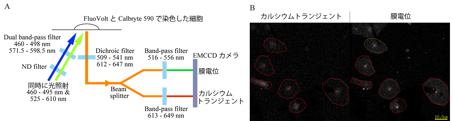 1型カテコラミン誘発性多形性心室頻拍(CPVT)iPS細胞から作製した単一の心筋細胞の活動電位とカルシウムイオン濃度の変化を同時光学記録
