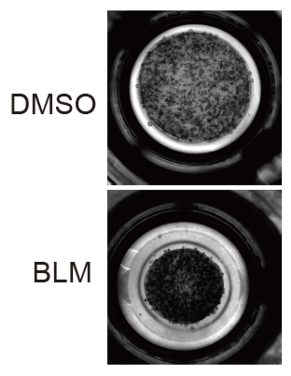 ヒトiPS細胞で肺線維症の「修復不全」を再現～病態をリセットする新たな治療標的候補を特定～