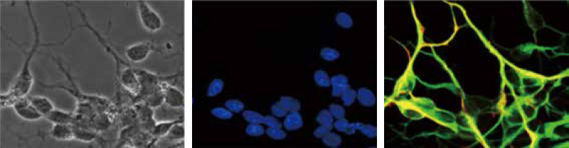 Differentiated NCCs imaged with different markers and microscopy