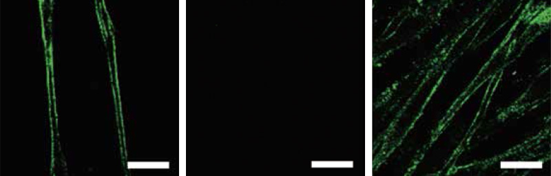 Differentiated NCCs imaged with different markers and microscopy