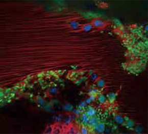 Blood vessel burst is beautiful, Koji Eto