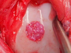 Particles consisting of chondrocytes and their secretions, ECM proteins.