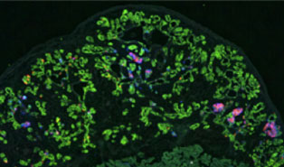 Pancreatic bud cells (green) formed tubular structures post implantation into mice.