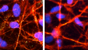 Photo A<em>β</em> oligomer in neurons