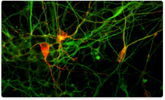 Human iPS cell-derived dopaminergic neurons