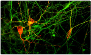 Human iPS cell-derived dopaminergic neurons