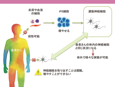 iPS細胞を使った創薬研究のまとめ(神経疾患の例)