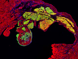 心筋梗塞マウスに移植したヒトiPS細胞由来心筋細胞